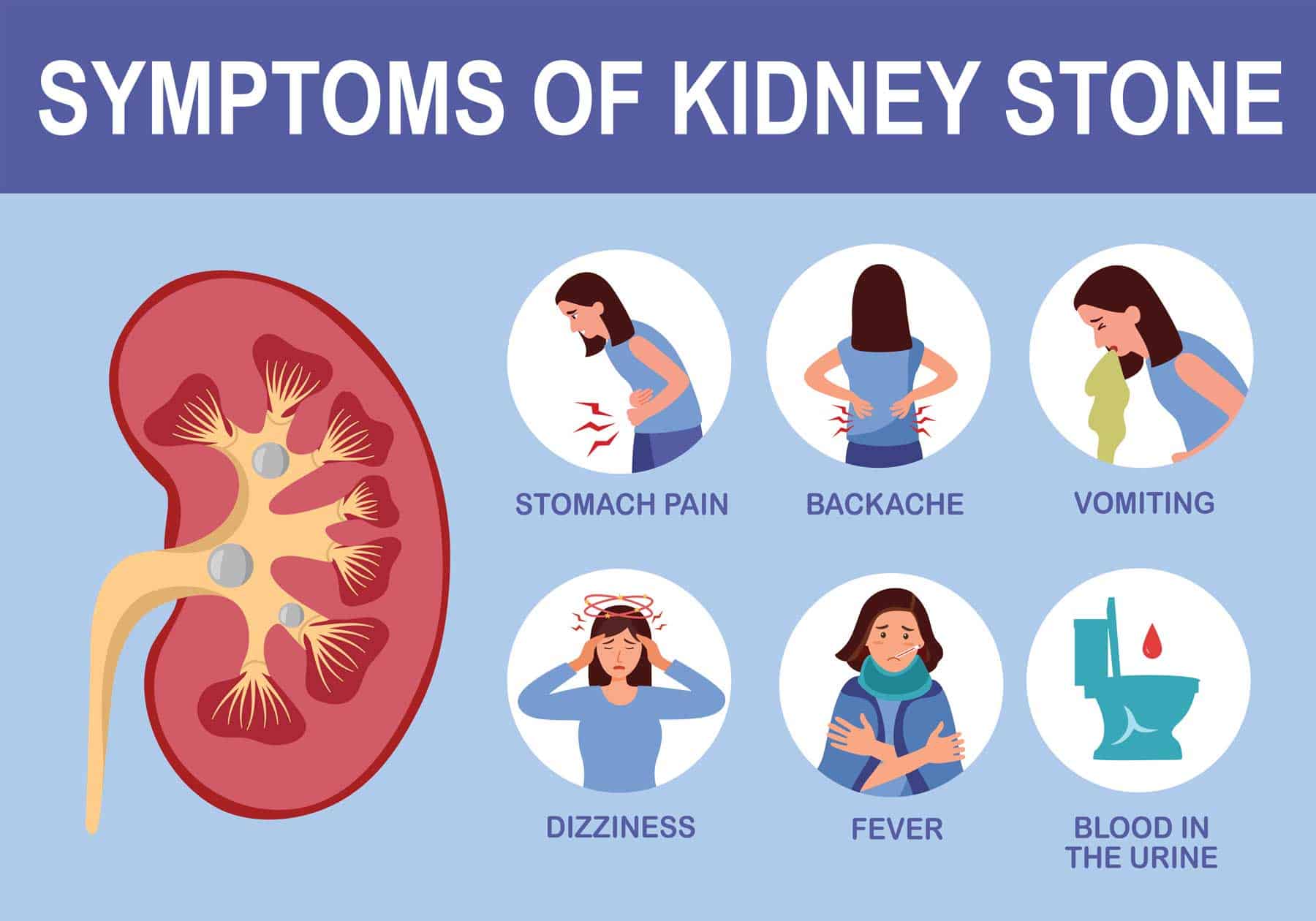 kidney-stones-plainfield-spine-and-rehabilitation